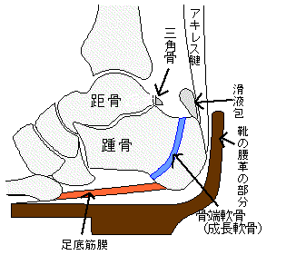 上 かかと 押す 痛い の と