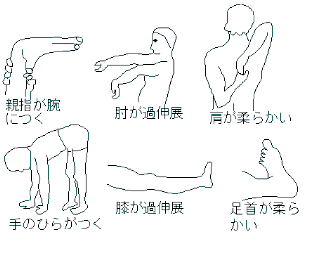 突然 と 膝 曲げる 痛い 急に膝が痛い現象が起こる原因と対処法